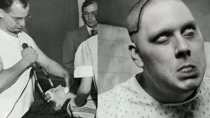 O Lado Sombrio da Ciência (A lobotomia)