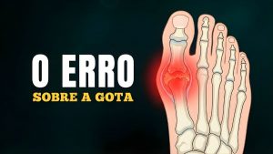 Ácido Úrico: O Verdadeiro Vilão (Não é a Carne Vermelha)